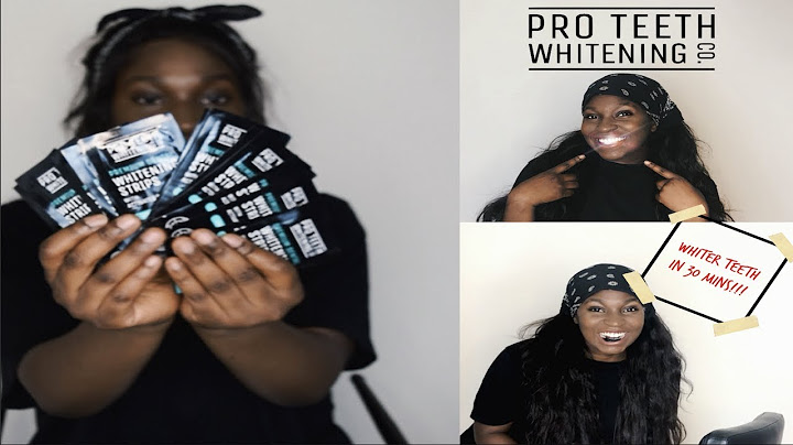 Pro teeth whitening co strips reviews năm 2024