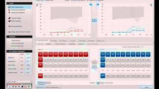 ReSound Aventa - Program handling