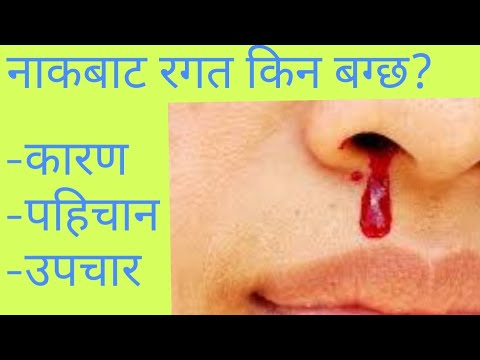 Nose bleed in Nepali|Dr Deepak Poudel |doctor sathi