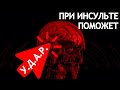 ЗАПОМНИ У.Д.А.Р. - СПАСЕШЬ ЧЕЛОВЕКА! КАК ОПРЕДЕЛИТЬ ИНСУЛЬТ? ЧТО ПРАВИЛЬНО ДЕЛАТЬ?