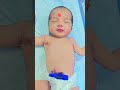 Baby admission in NICU for phothotherpy #shorts #newbornarrival #nicu #yputubeshorts