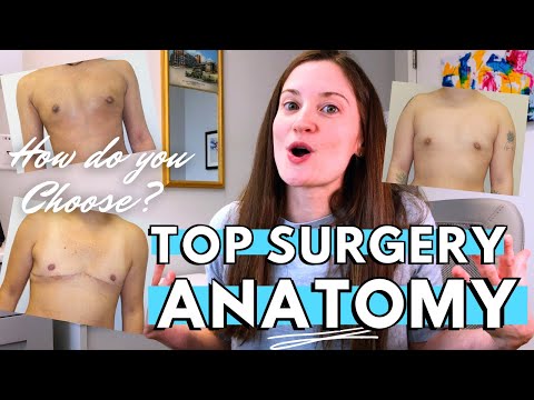 Video: Hur man väljer en kirurg för toppkirurgi: 12 steg