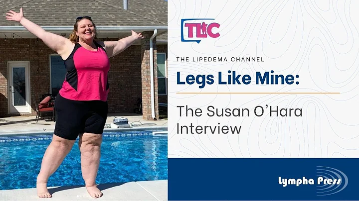 Legs Like Mine: The Susan O'Hara Interview