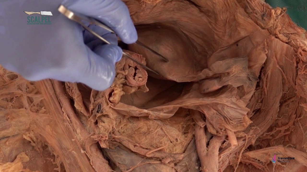 Pelvis Part-5: Uterus - YouTube