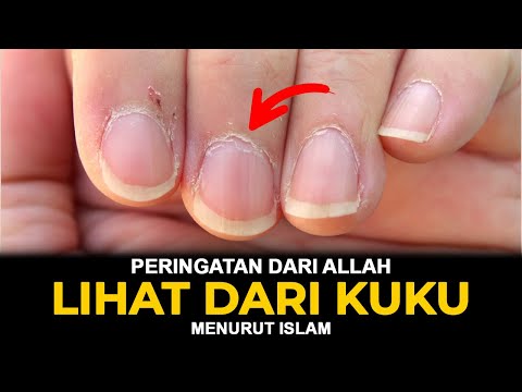 Thumbnail YouTube