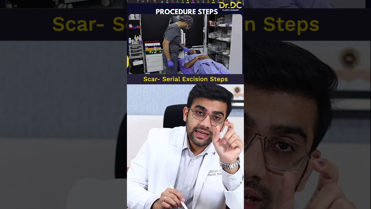 How Scar Revision Surgery Works: Step-by-Step Procedure! | Dr DC, Plastic Surgeon | Pune