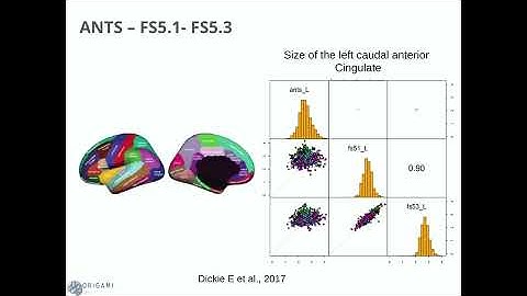 OHBM 2025 | Educational Course | Analytical variability of brain imaging pipeline | Part 1