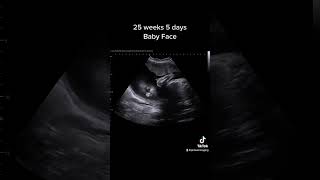 25 Weeks 5 Days Baby Face