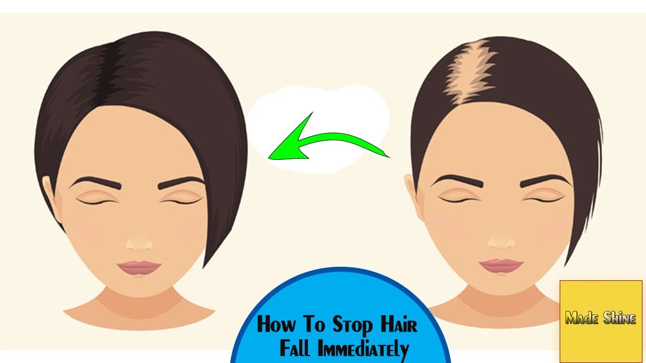 how to stop spotting immediately home remedies