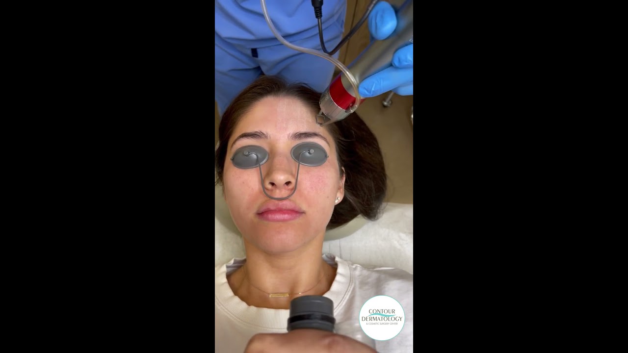 Erbium Laser Easy And Fast Treatment YouTube Erbium Laser Easy And Fast Treatment YouTube