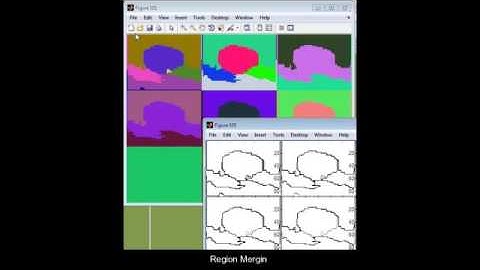 Automatic Skin Lesion Segmentation via Iterative Stochastic Region Merging Matlab Project