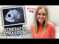 FIRST ULTRASOUND APPOINTMENT! (So Nervous)