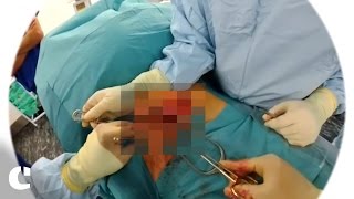 Doctor Uses Snapchat Spectacles For The First-Ever Lifestream Surgery