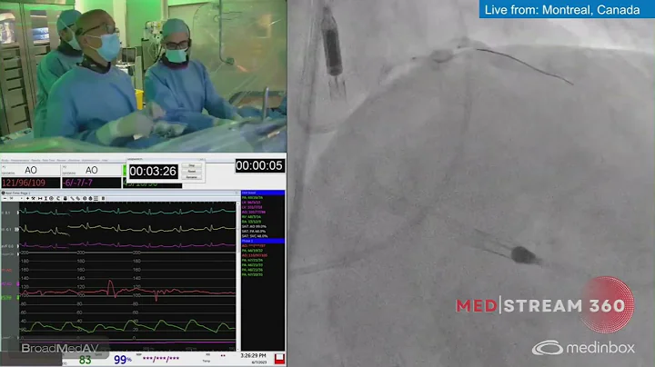 Impella-Assisted PCI Of LAD And LCx Guided By OCT