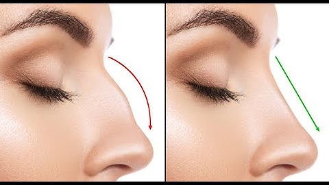 nose surgery animation