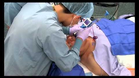 A second look at the UEscope from AOD