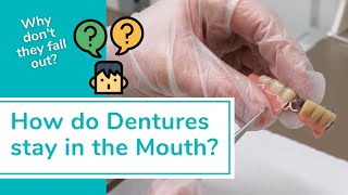How do DENTURES STAY IN THE MOUTH? Lower Dentures, Uppers & Partials