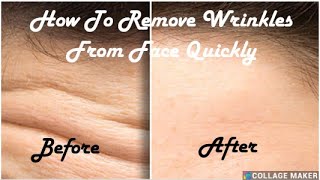 How To Remove Wrinkles From Face Fast In Just 3 Days/Urdu/Hindi