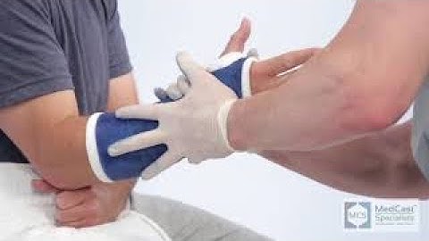 How To Apply A Short Arm Cast - Easy - With Cast Removal