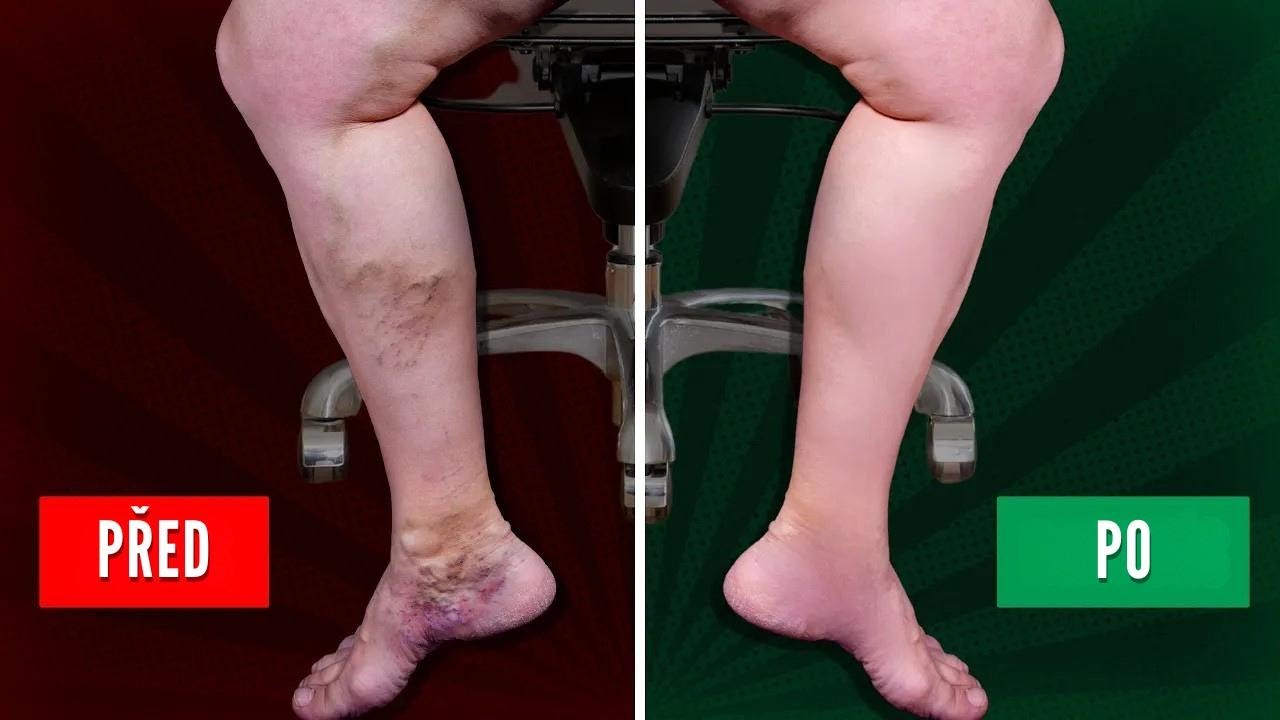 5 cviků pro lepší krevní oběh v nohách při sezení v práci