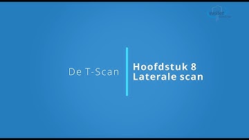 Hoe neem je een laterale scan af met de T-Scan?