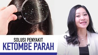 Ketombe Parah: Penyebab, Gejala, dan Cara Mengatasinya | Kata Dokter