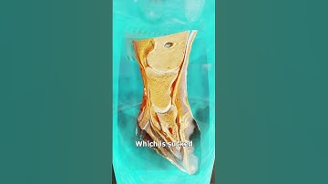 How Plastination Works 🤔
