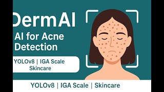DermAI: Automated Acne Detection Using YOLOv8 & Deep Learning | FYP – FAST University screenshot 3