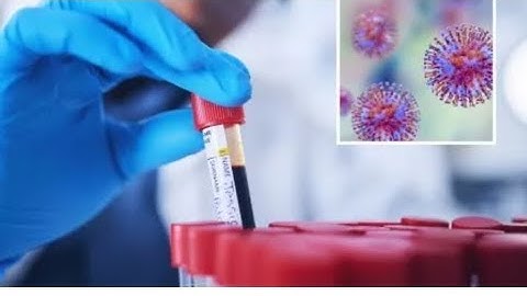 Hundreds of Vials of Deadly Viruses Missing After Lab Breach