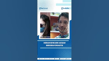 Kimberly Ryder Heran Edward Akbar Berubah Drastis