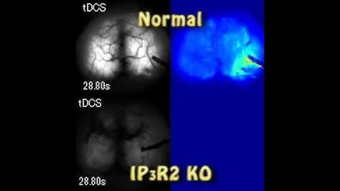 tDCS induces astrocytic calcium surges