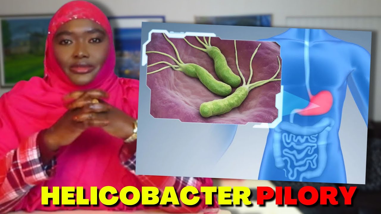 GAASTARIIGA WAXAA SABABA H-PYLORI, CALAAMADAHA AAD ISKU ARKI KARTID! DARYEELKA IYO GOORMO DHAQTARKA?