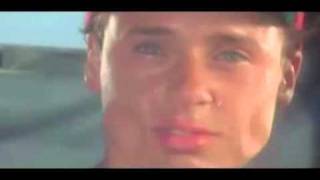chad lowe cheek flap Wealth