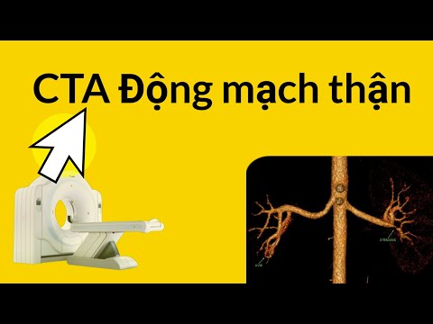 CTA Động mạch thận