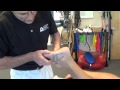 Ankle: Cuboid Whip | Physical Therapy IAOM-US