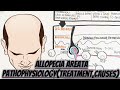 Allopecia areata pathophysiology treatment and causes umerfarooqbiology7083