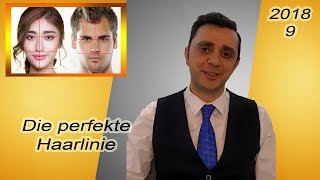 Perfekte Haarlinie | Haartransplantation