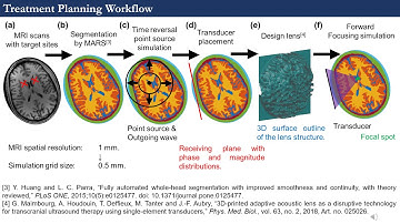 Cheng - Transcranial Ultrasound Stimulation: Noninvasive Hippocampus Neuromodulation (Poster) (2020)