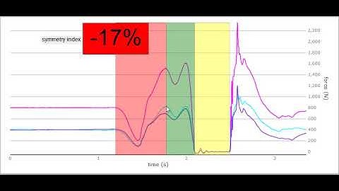 Left to Right Symmetry Analysis - From a single force platform!