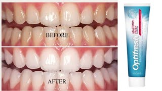 Teeth whiting at home || Easy teeth whiting at home || The best way to whiten teeth || Teeth white