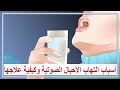 أسباب التهاب الأحبال الصوتية وكيفية علاجها