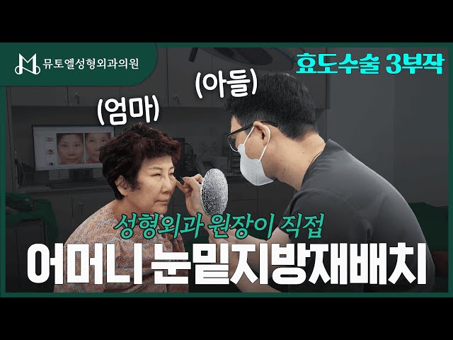 [효도수술 3부작] 의사 아들한테 직접 받아본 눈밑지방재배치 후기 #성형외과 #성형외과의사 #용산역 #눈밑지방재배치 #눈밑지방 #눈밑지 #지방이식 #눈가주름 #동안성형 #동안비결