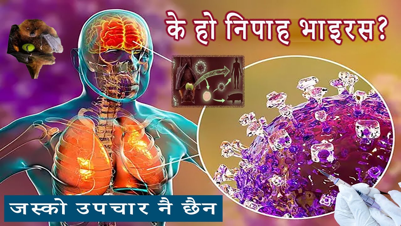 High Alert !!! के हो निपाह भाइरस (Nipah Virus) जस्को उपचार नै छैन ?