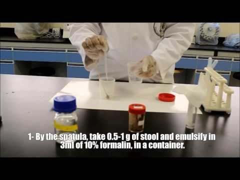 Microscopic examinations of stool sample