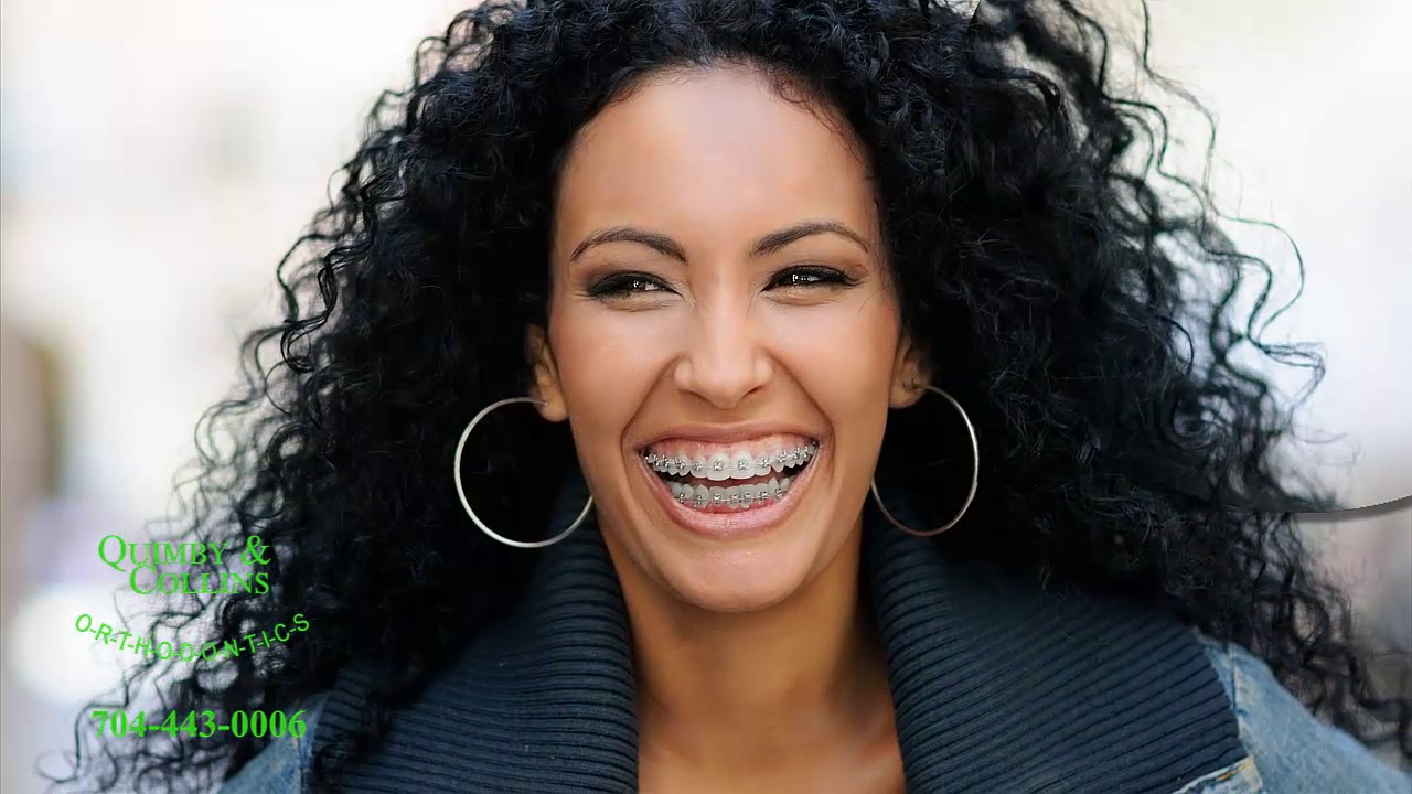 Best Orthodontists Charlotte NC Invisalign Braces Teens Adults