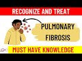 What is Pulmonary Fibrosis | All you need to know | Causes | Treatment | Prevention