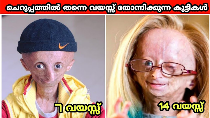 ചെറുപ്പത്തിൽ തന്നെ വയസ്സ് തോന്നിക്കുന്ന കുട്ടികൾ /UNUSUAL KIDS Who Look Much Older Than Their Age