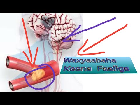 Waxyaabaha Keena Xanuunka Faaliga |2019|