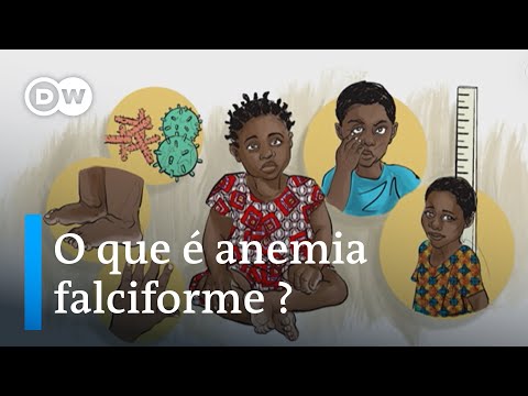 Anemia falciforme afeta