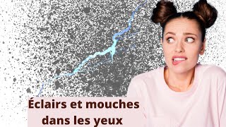 Pourquoi j’ai des éclairs et des points noirs dans les yeux ? (Symptômes des problèmes oculaires)